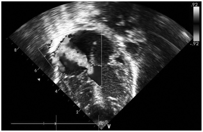 Fig. 1