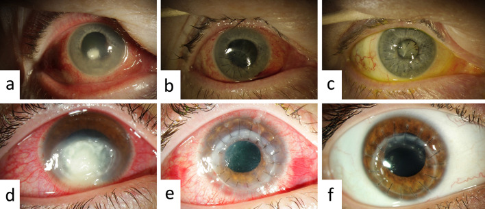 Fig. 1