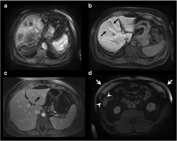 Fig. 13