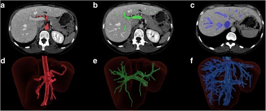 Fig. 15