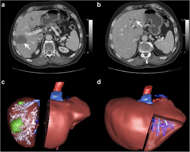 Fig. 16