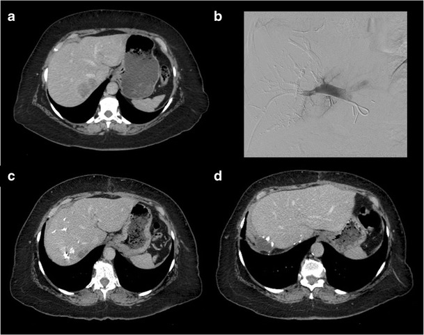 Fig. 5