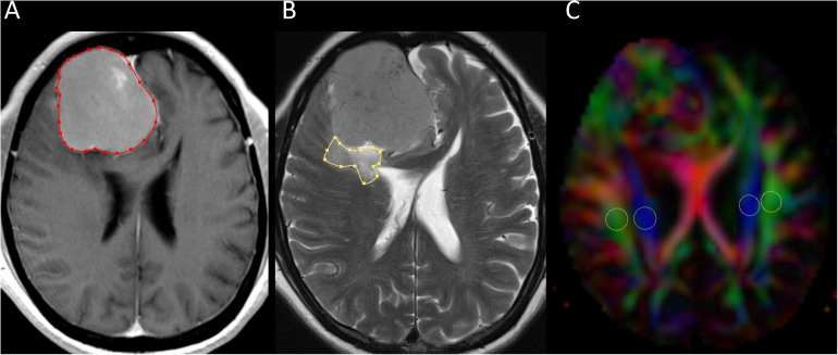 FIGURE 1