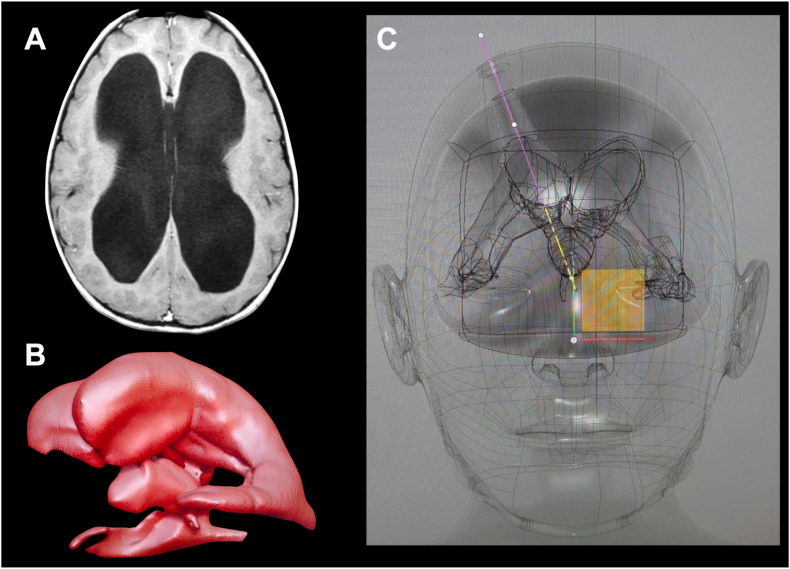 Fig. 1