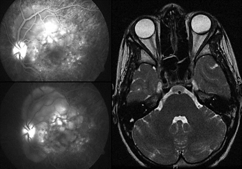 Fig. 2