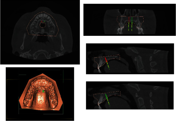 Figure 6