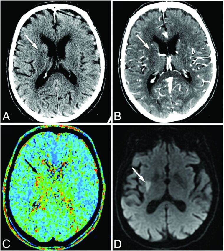 Fig 2.