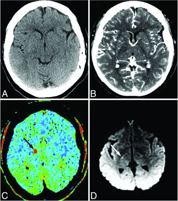 Fig 3.