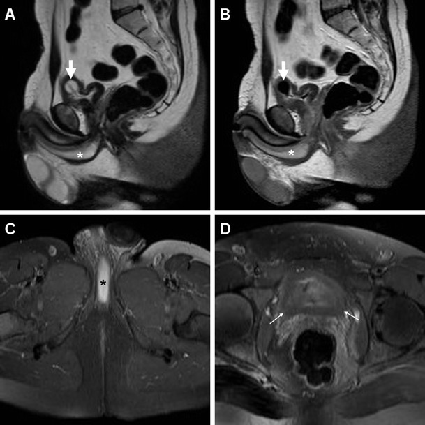 Fig. 14