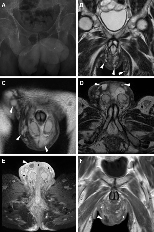 Fig. 21