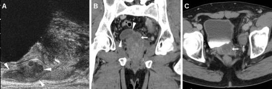 Fig. 12