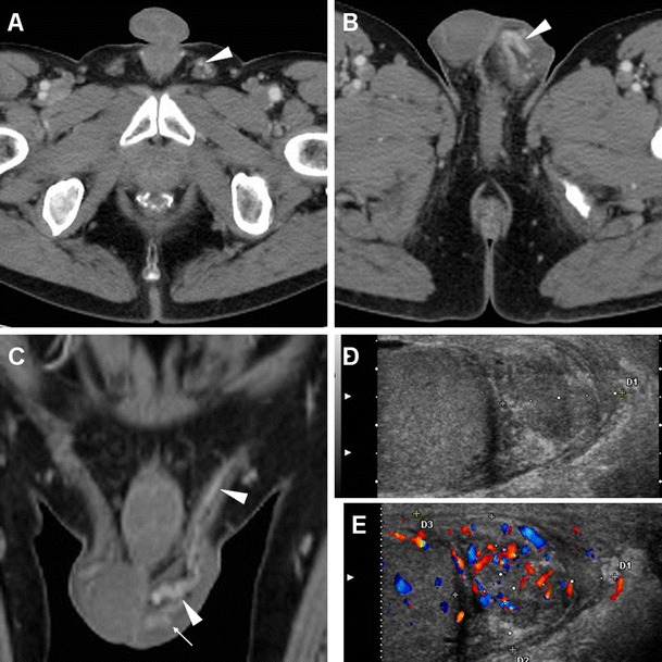 Fig. 16