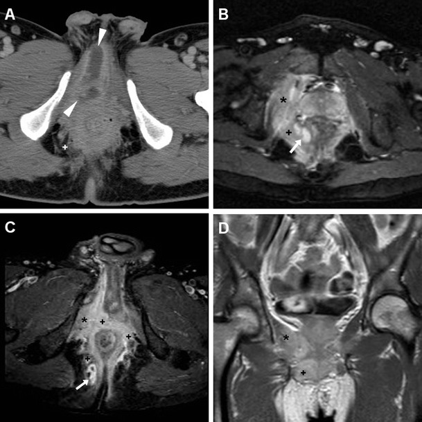 Fig. 20