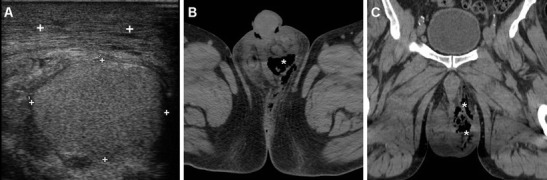 Fig. 19