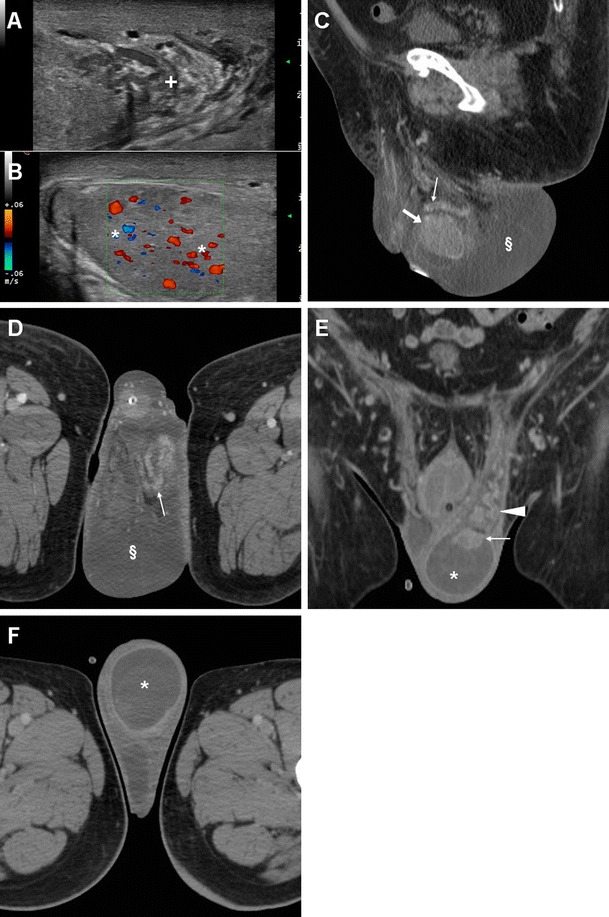 Fig. 18