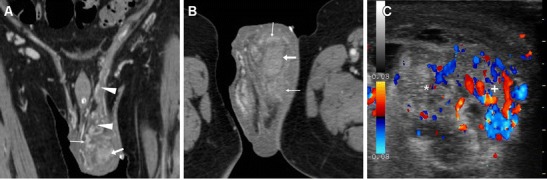 Fig. 17