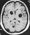 FIG.2-9.