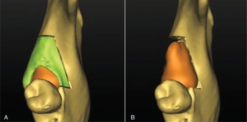 FIGURE 4