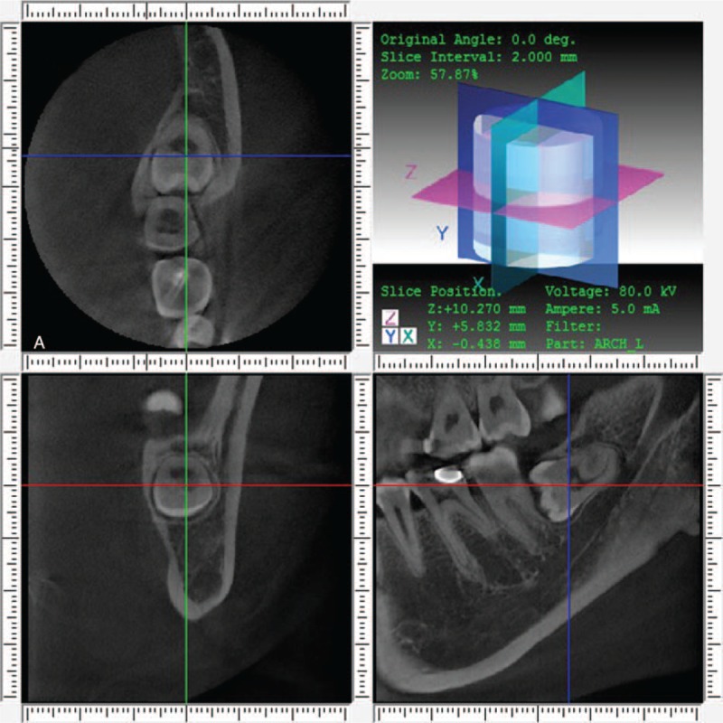 FIGURE 1