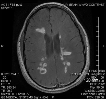 Fig. (2)