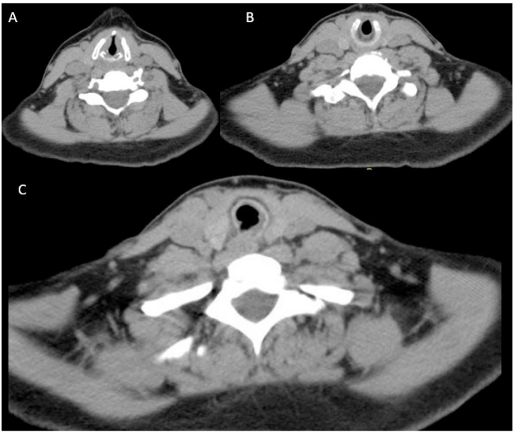 Fig. 2
