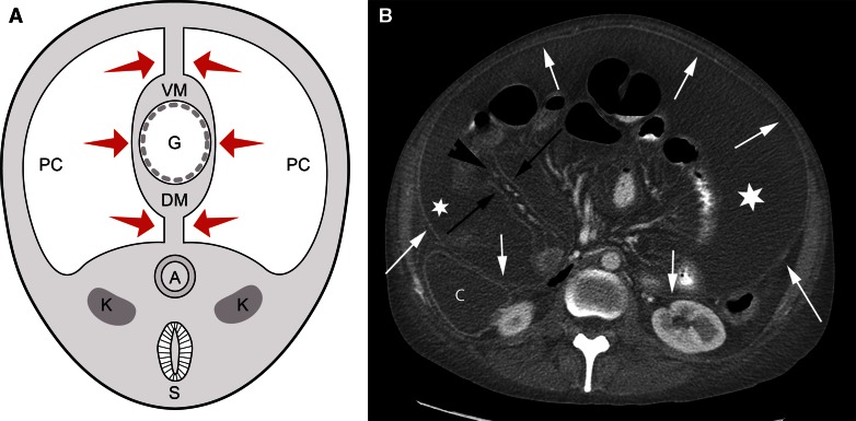 Fig. 2