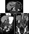 Fig. 10