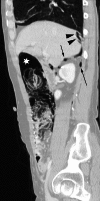 Fig. 9