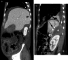Fig. 11