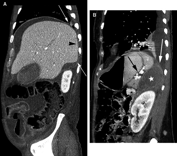 Fig. 11