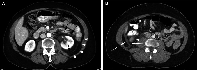 Fig. 4