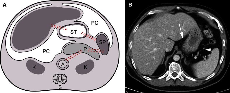 Fig. 3