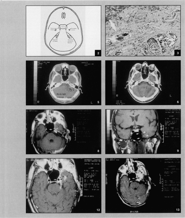 Figures 2,3,5,6,8,9,12,13