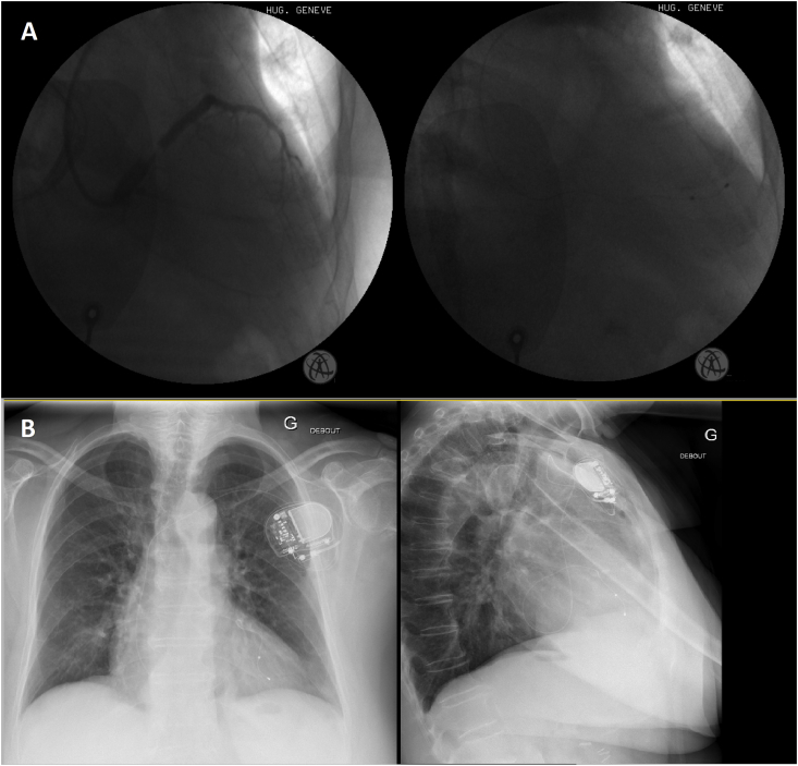 Fig. 1