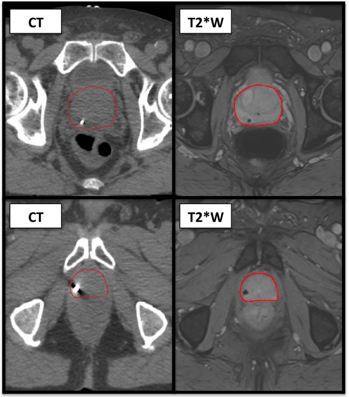 Figure 5