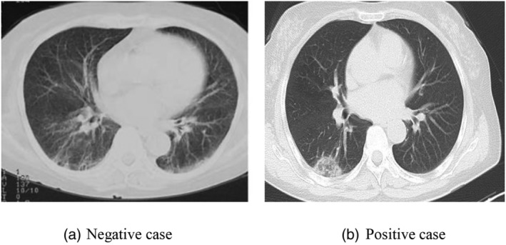 FIGURE 14