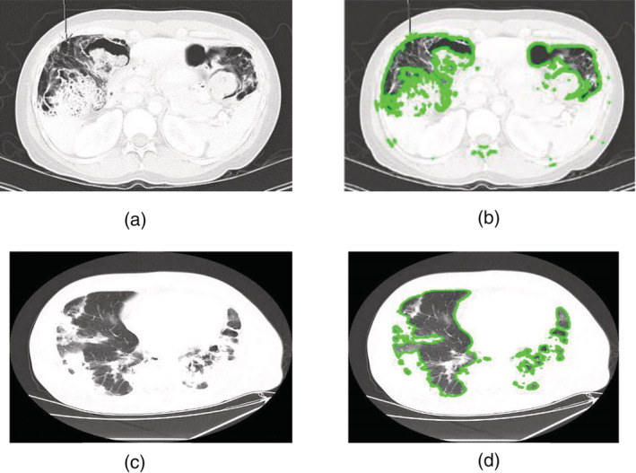 FIGURE 13