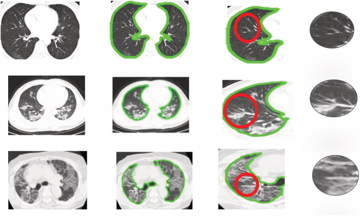 FIGURE 11