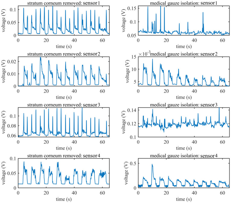 Figure 11