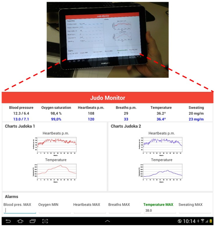 Figure 21