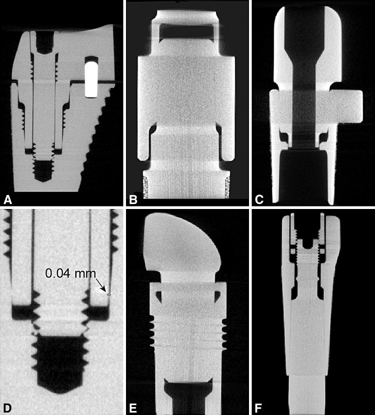 Fig. 4A–F