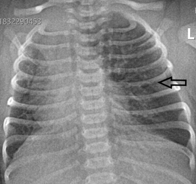 Fig 1