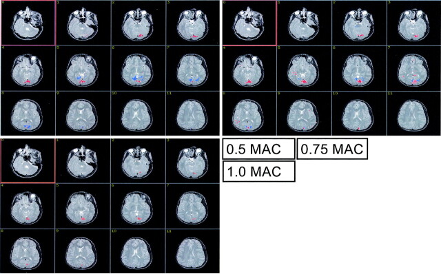 Fig 1.