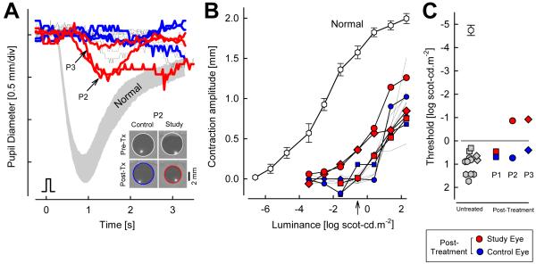 Figure 17