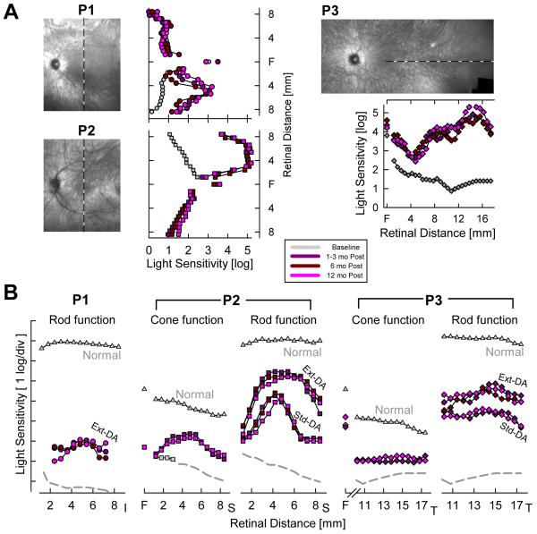 Figure 14