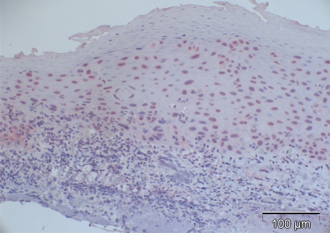 Fig. (4b).