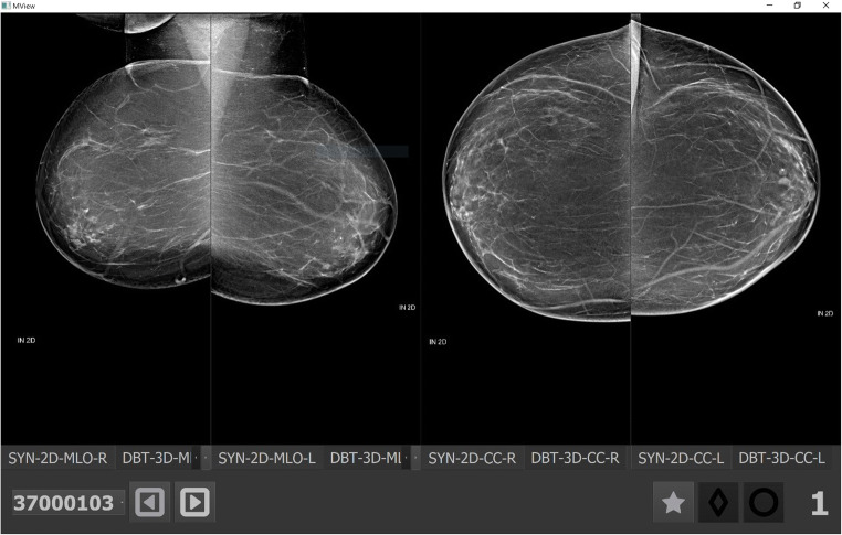 Fig. 4