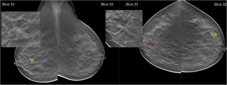 Fig. 5