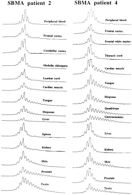 Figure  1