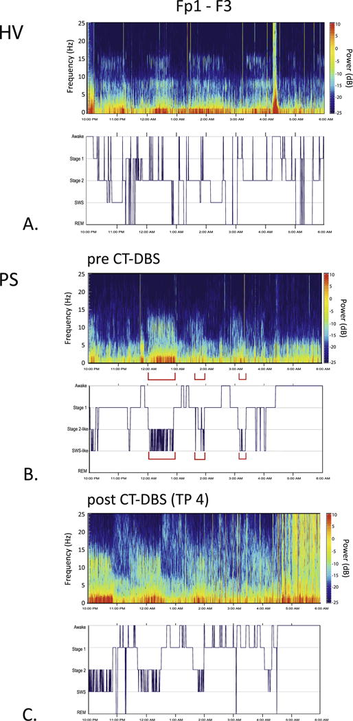 Fig. 3